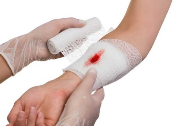 Cách sơ cứu vết thương chảy máu để tránh nhiễm trùng